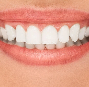 Mârturii despre serviciile stomatologice oferite de echipa CrinaDent Cluj