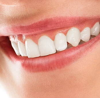 Mârturii despre serviciile stomatologice oferite de echipa CrinaDent Cluj