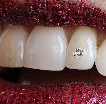 Mârturii despre serviciile stomatologice oferite de echipa CrinaDent Cluj